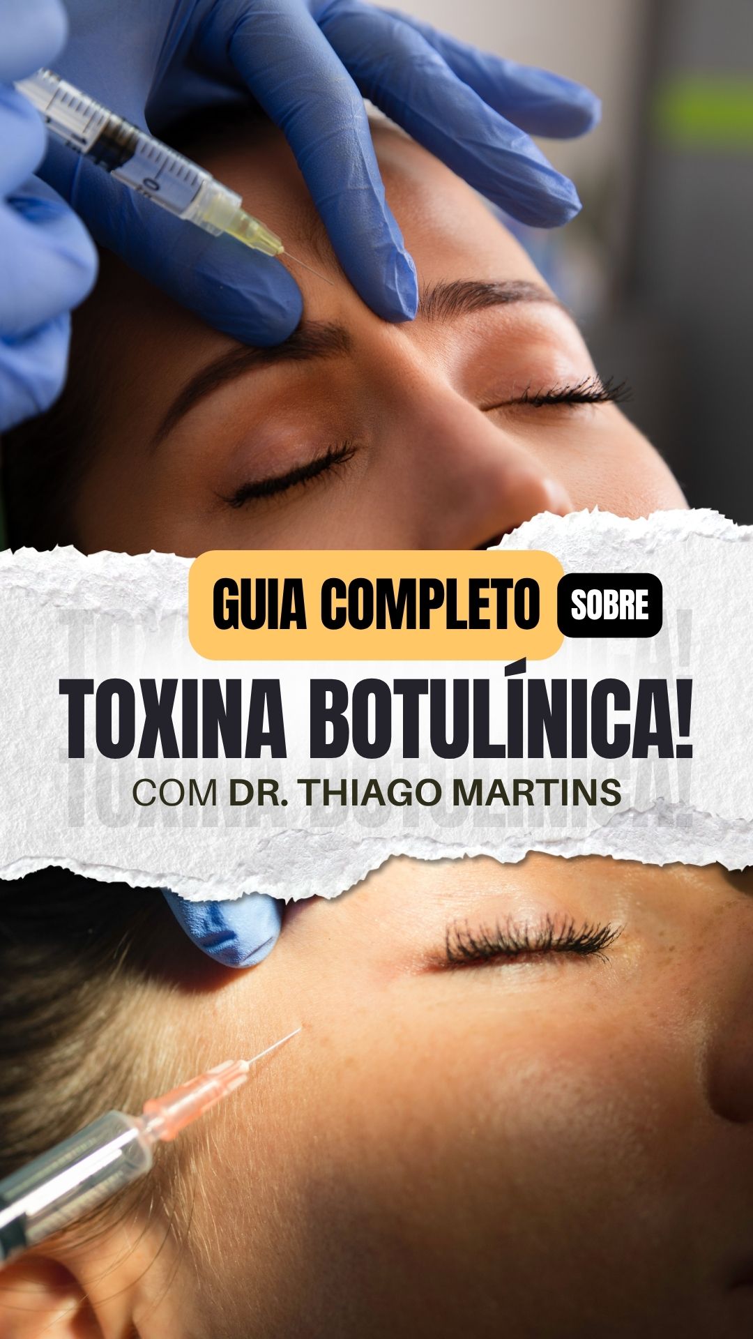 Capa Toxina Botulínica