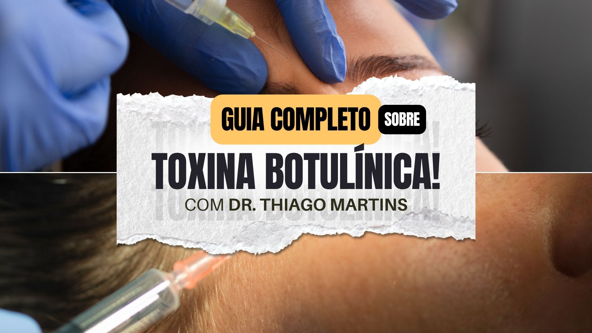 Capa do e-book Toxina Botulínica na Estética